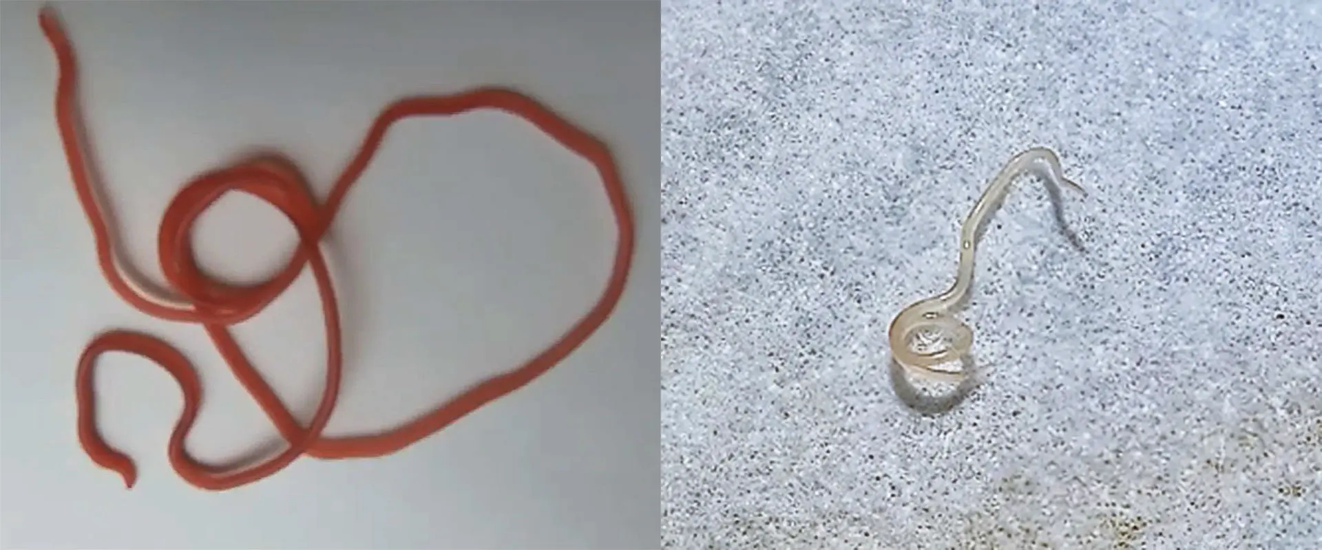 アニサキスとどう見分ける？